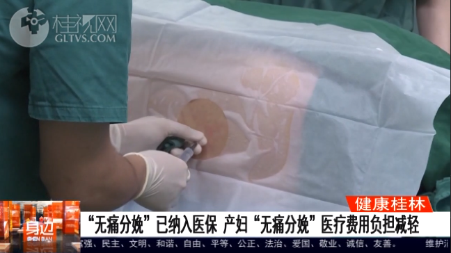 桂林广播电视台：“无痛分娩”已纳入医保 产妇“无痛分娩”医疗费用负担减轻
